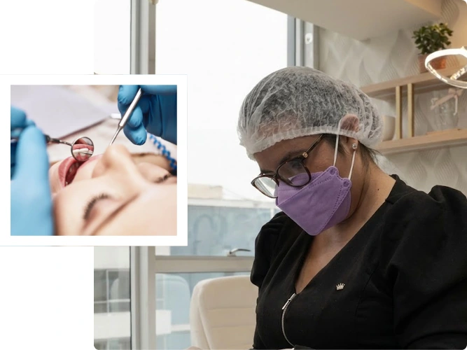 Por qué elegirnos para tu tratamiento de periodoncia en Lima