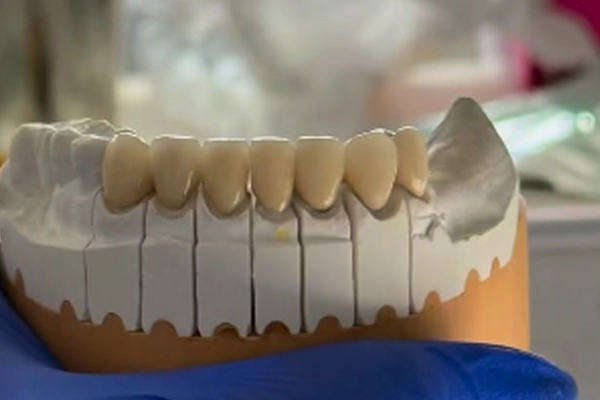 Qué es la cirugía oral
