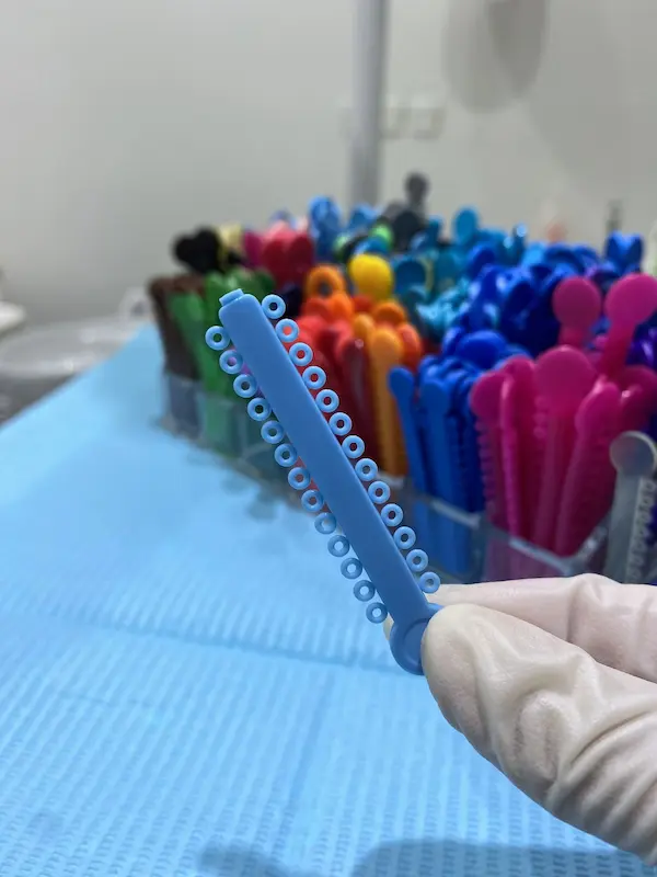 Mejores colores de ligas para brackets en una sonrisa