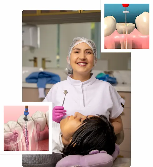 Endodoncia unirradicular en Lima Perú​