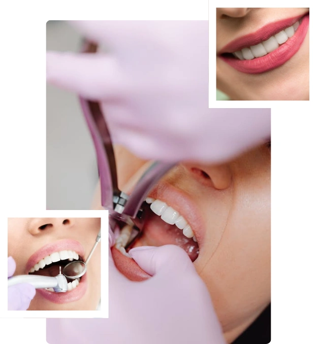 Extracción dental en Lima Perú
