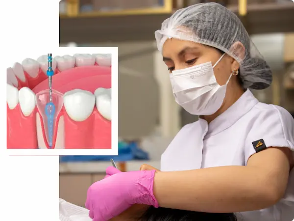 Los mejores resultados en endodoncia unirradicular en Lima con un enfoque preciso