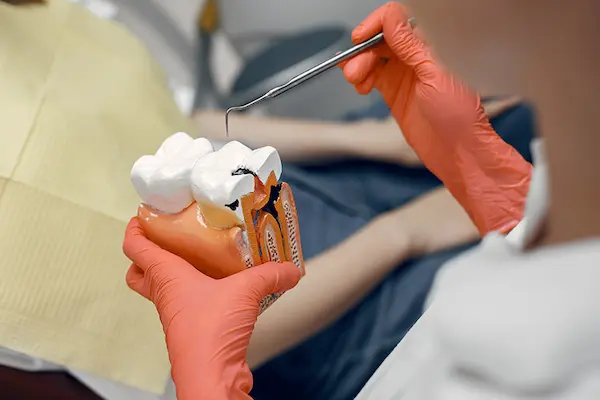 Prevención de infecciones severas y abscesos