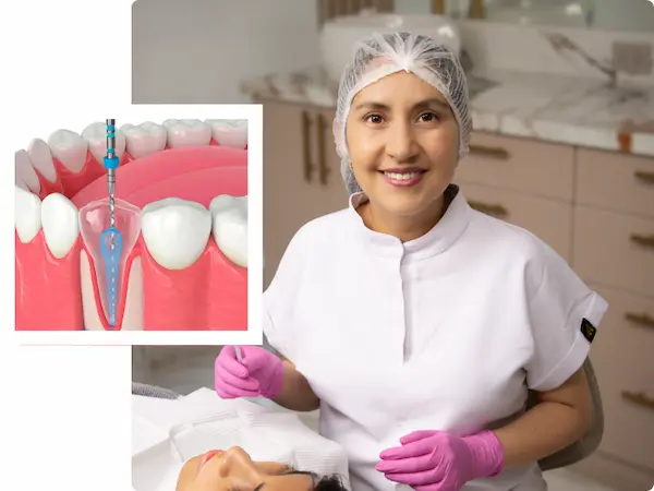Solución para dolor dental interno con endodoncia unirradicular en Lima
