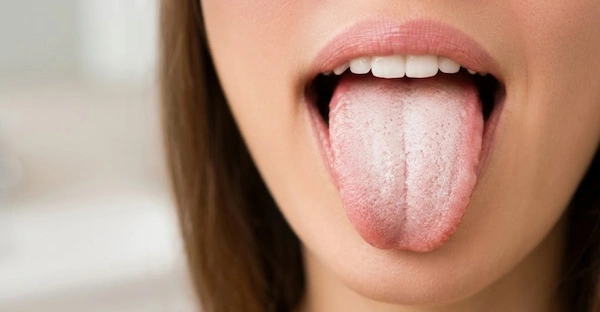 lengua blanca