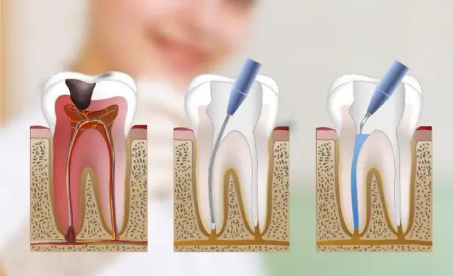 Ajustes según la evolución del caso