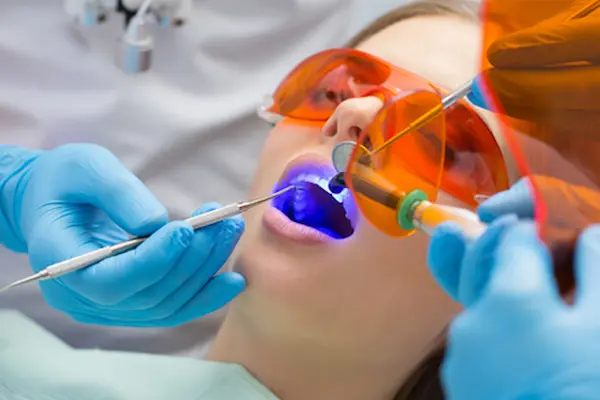 Blanqueamiento dental LED o con lámpara de luz fría