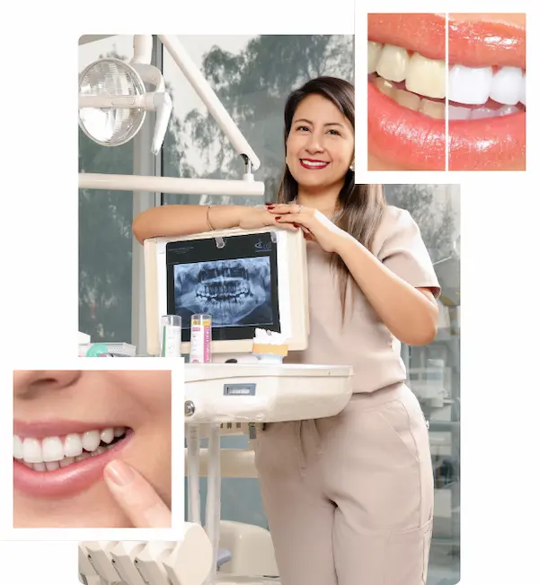 Blanqueamiento dental en Lima, Perú