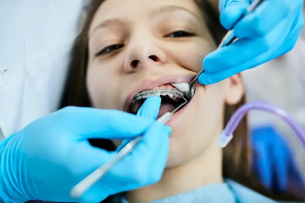 Cambios en la posición dental