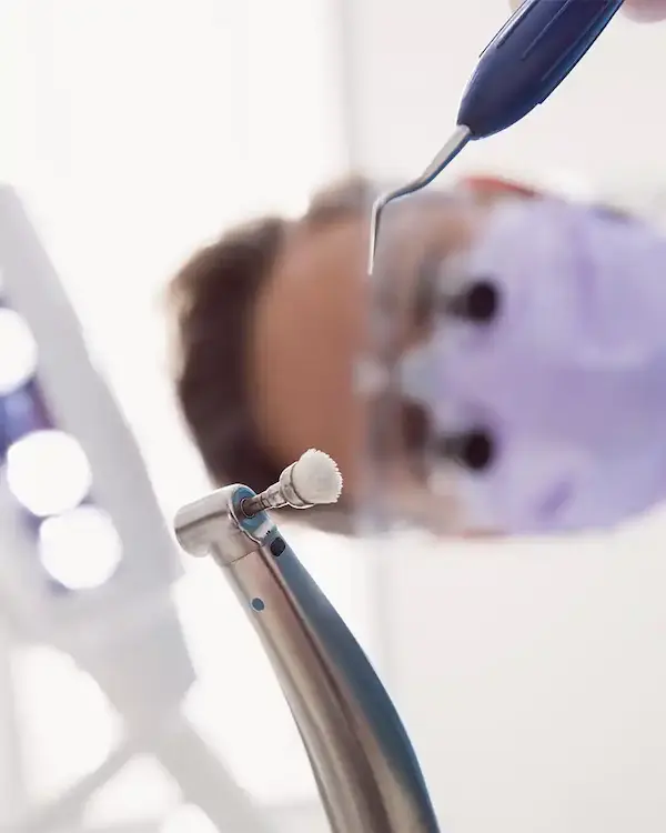 Diferencias clave entre limpieza dental y destartraje