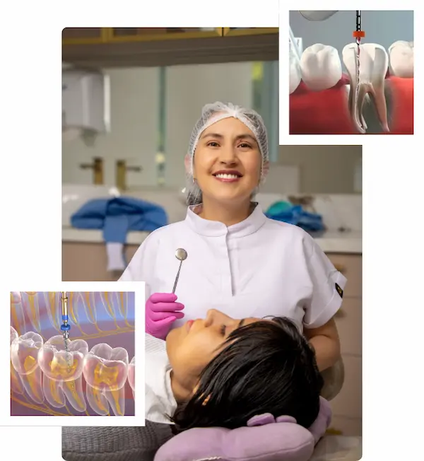 Endodoncia multirradicular en Lima Perú
