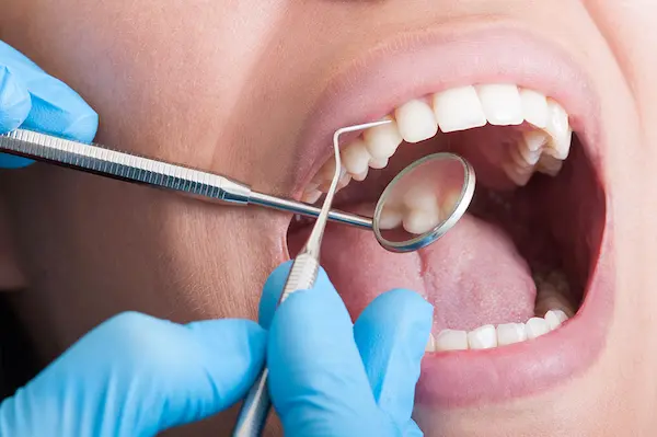 Evaluación clínica y diagnóstico periodontal profesional