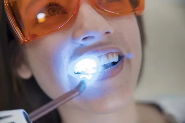 Evaluación previa de la sensibilidad dental
