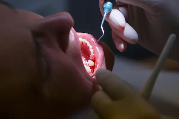 Impacto en la salud sistémica y riesgo cardiovascular