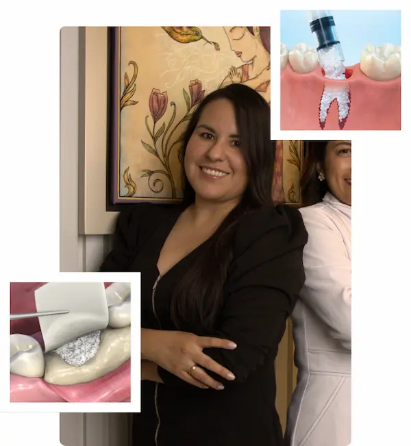 Injerto óseo dental Regeneración ósea dental en Lima Perú