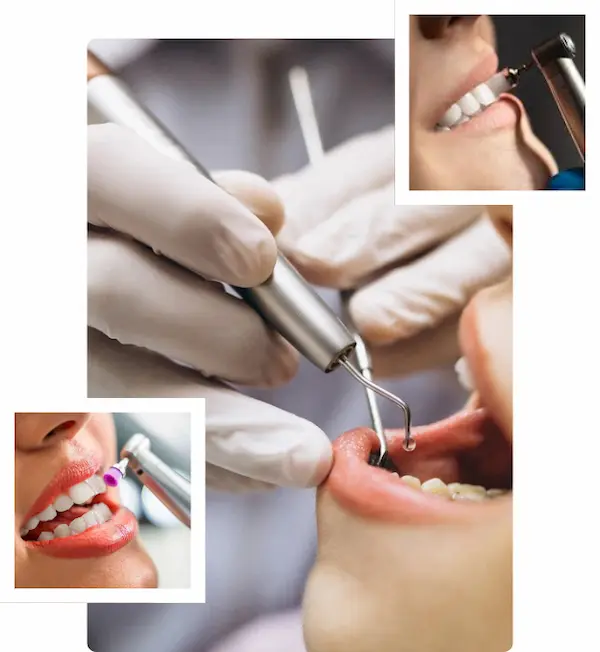 Limpieza dental en Magdalena Profilaxis y destartraje