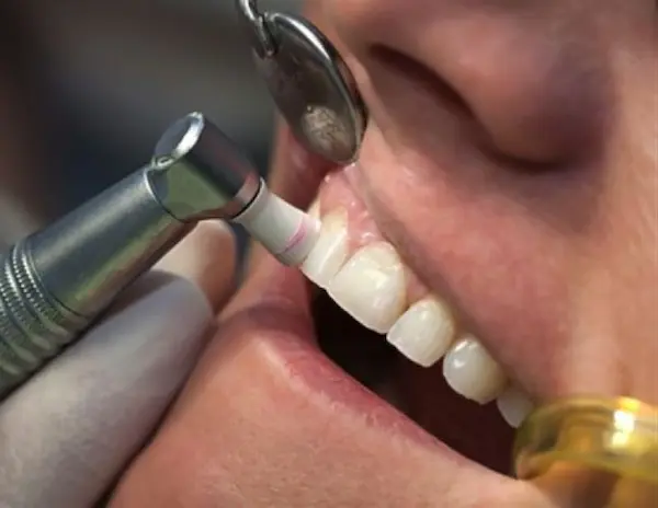 Qué pasa si no se trata la enfermedad periodontal