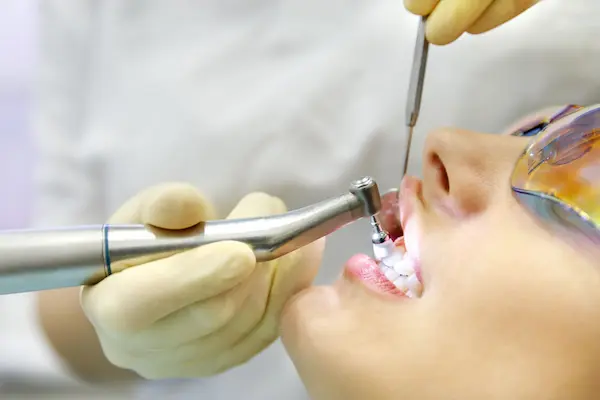Qué se logra al realizar una profilaxis dental a tiempo