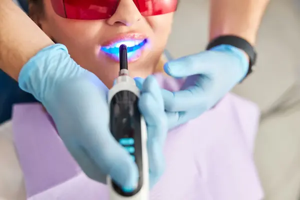 Resultados reales y visibles del blanqueamiento dental
