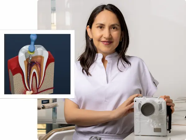Solución para casos complejos en dientes con múltiples raíces