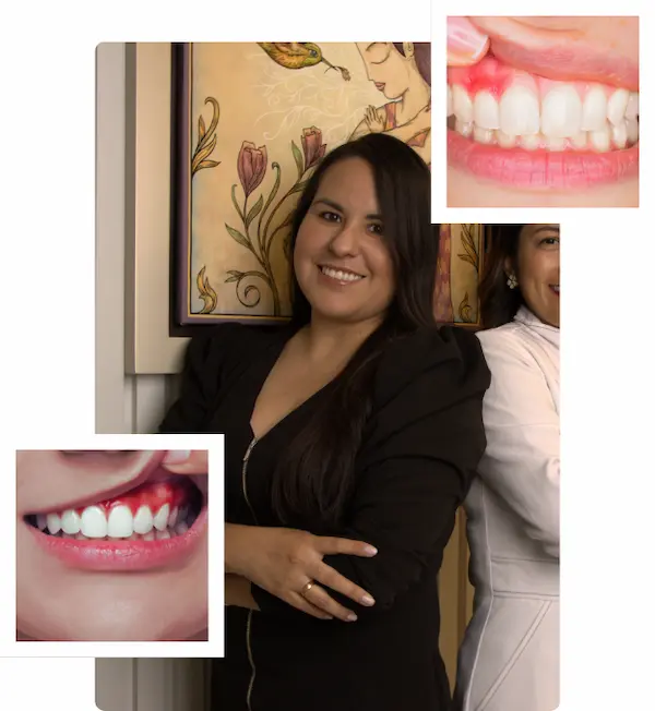 Tratamiento de la enfermedad periodontal en Lima Perú