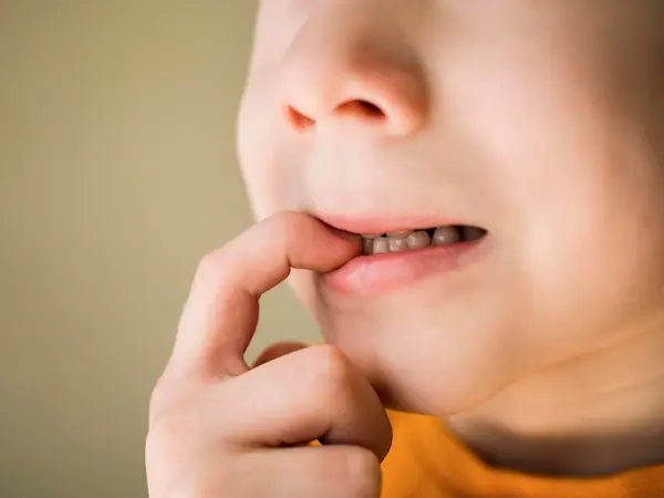 Cuándo se caen los dientes de leche
