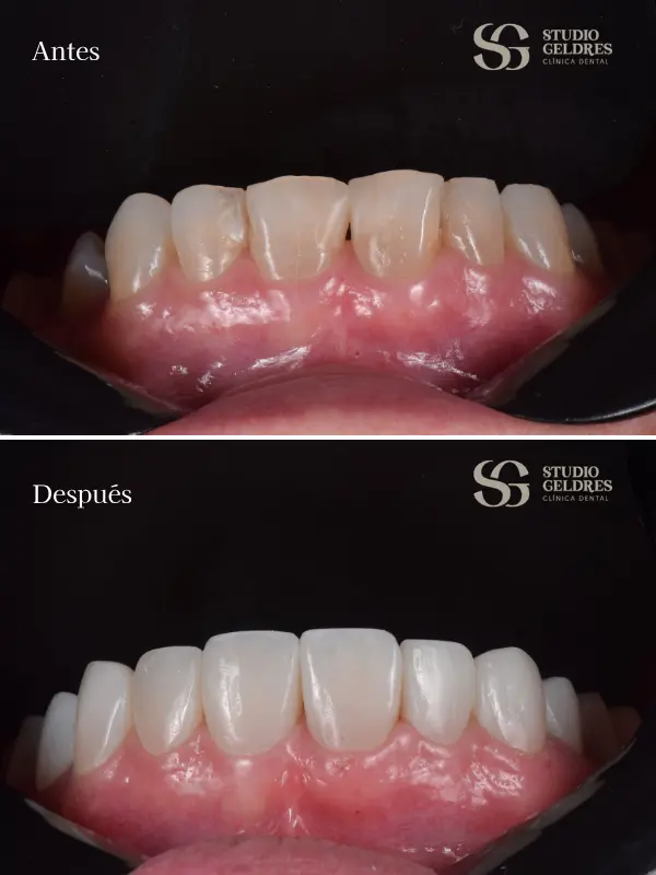 Dentistas en Lima con resultados reales de mejora dental