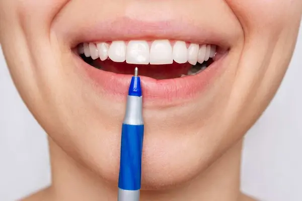 Las manchas blancas en los dientes se pueden quitar