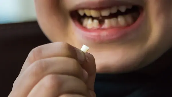 Qué son los dientes de leche