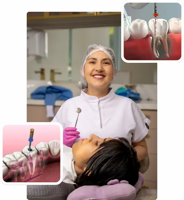 Endodoncia en Lima, Perú
