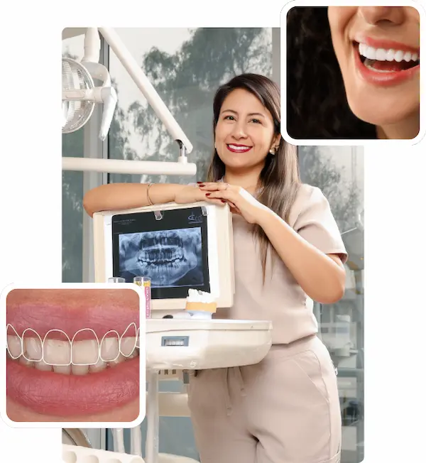 Estética dental en Lima, Perú