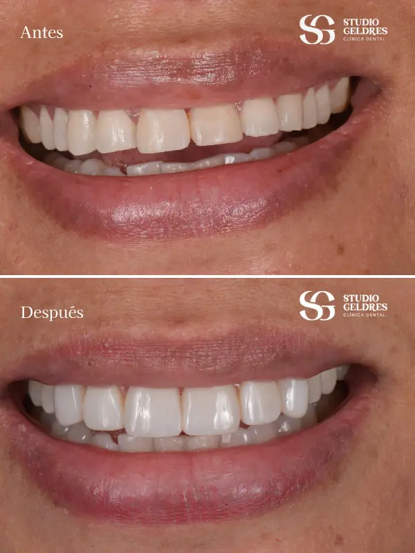 Obtén la sonrisa perfecta con nosotros