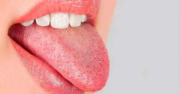 Por qué el color de la lengua importa