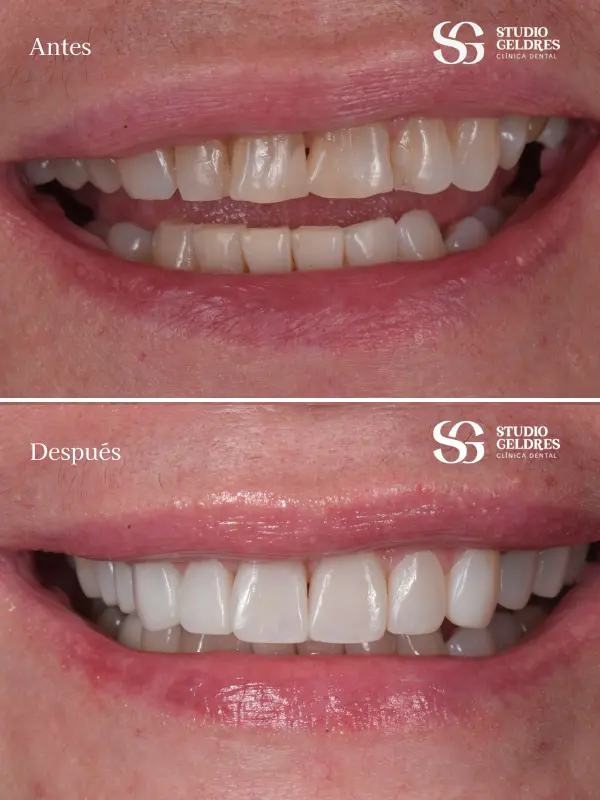 casos reales en rehabilitación oral