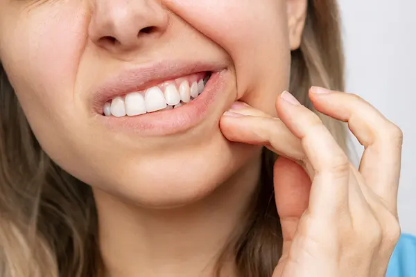 ¿Qué no debes hacer para aliviar la sensibilidad dental