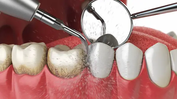 Niño utilizando un cepillo dental infantil bajo la supervisión de un adulto