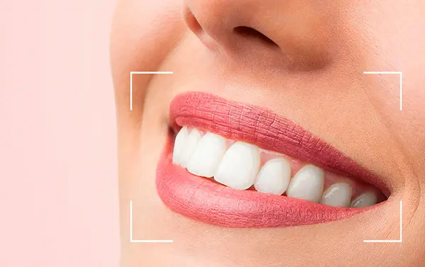 ¿Qué es un diseño de sonrisa