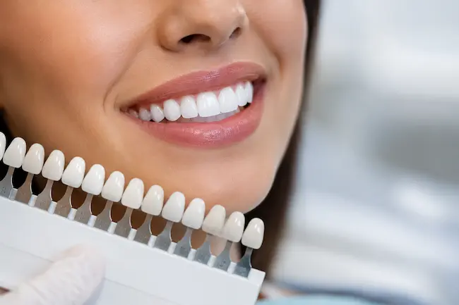 estética dental para mejorar la apariencia de la sonrisa
