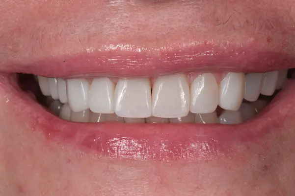 Una sonrisa que se sienta bien para ti