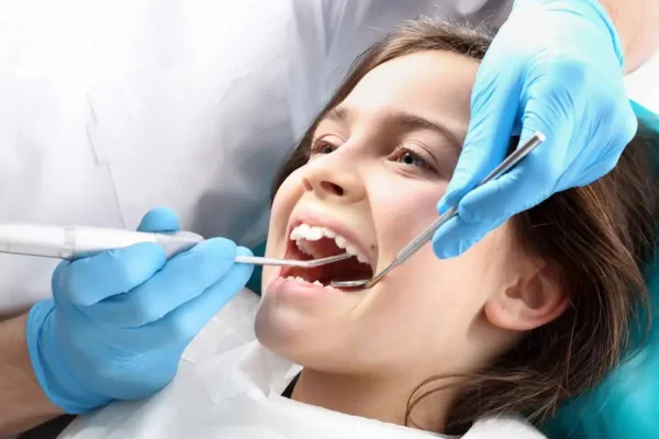 Caries infantil