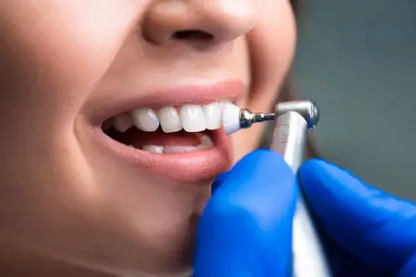 Evaluación inicial del estado dental