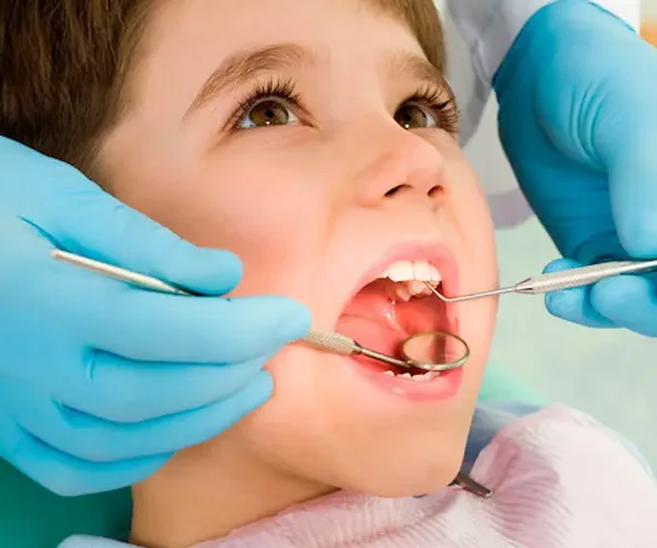 Tratamiento de caries infantil
